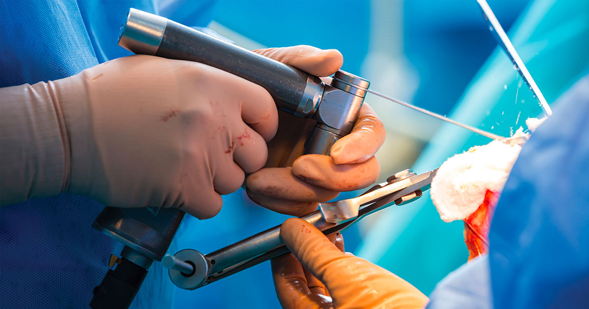 Joint Replacement Surgeries