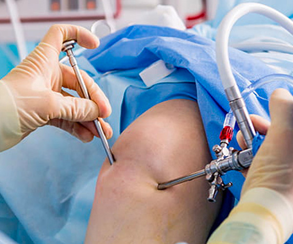 joint and knee surgery in mumbai