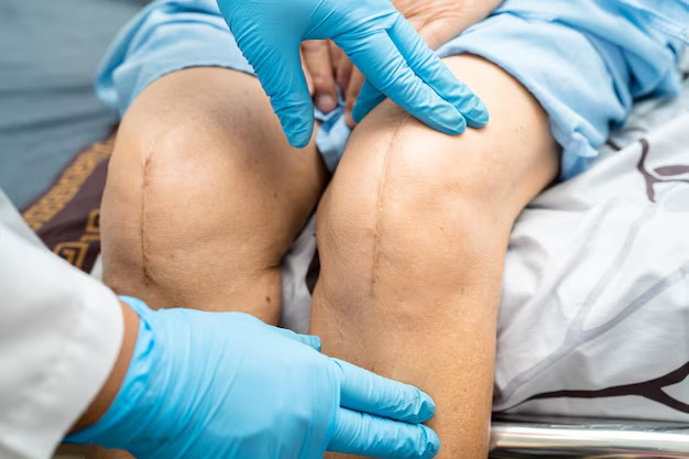 postoperative joint and knee surgery in mumbai
